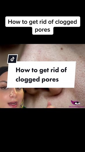 Effective Tips for Minimizing and Cleaning Clogged Pores