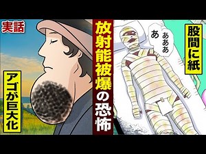【実話】放射能被爆の恐怖。アゴが腐って巨大化…股間は紙一枚。
