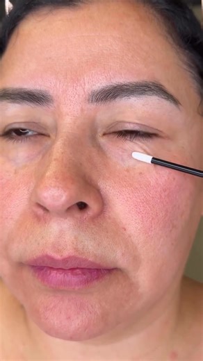 What is Plasma Lift? ✨Plasma Lift (also called Fibroblast Skin Tightening) is a non-surgical treatment that uses plasma energy to stimulate your skin’s natural collagen elastin 👩‍⚕️💎That means:✔️ Tighter, firmer skin✔️ Reduction of fine lines & wrinkles✔️ Lifts areas like eyelids, smile lines, jawline & neck✔️ Improves skin texture tone ✨The best part? 👉 Minimal downtime & long-lasting, natural results 🌸📲 DM me to book your consultation and see if Plasma Lift is right for you 💕📍 [Concord,