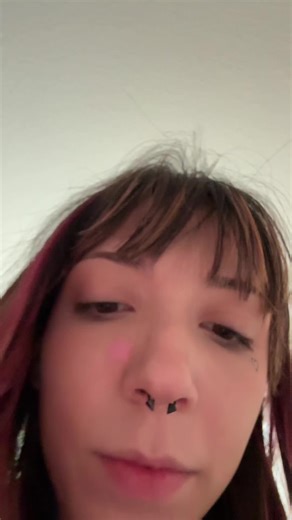 Hyperhidrosis: Managing Excessive Sweating