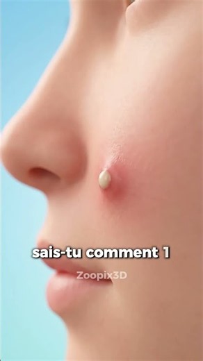 Sais-tu comment un bouton se forme vraiment sous ta peau ? 😬🔬