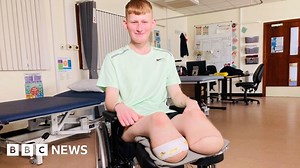 Teenage footballer who lost his lower legs just happy to be alive