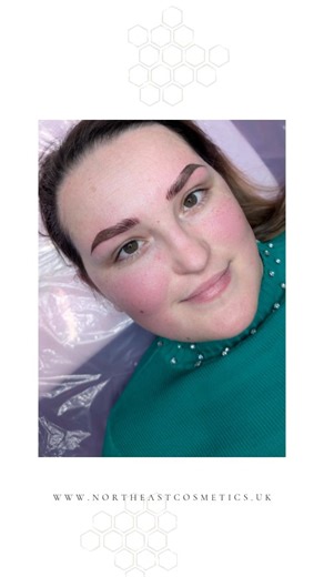 ✨ Check Out this Brow Journey ✨ Sophie came to see me with very sparse brows and a noticeable loss through the mid-to-tail area. In just two treatments we carefully restored shape, balance and softness — and this is the result. What I love most isn’t just the transformation, but knowing we’ve changed her mornings. No more stressing, pencilling or trying to make brows appear where they were missing. Just waking up and feeling like herself again. SPMU 2x treatments required 8 weeks apart Maintenan