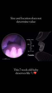 Every life is valuable. 👣❤️ | Illinois Family Institute