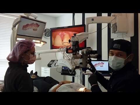 O que é Microscopia Odontológica? Dr Rogério Marcondes | Dental Esthetic Center