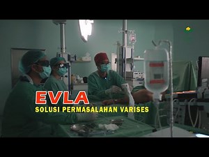 EVLA Kaki Indah dan Sehat Tanpa Varises