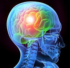 Mild Neurocognitive Disorder Due To Traumatic Brain Injury