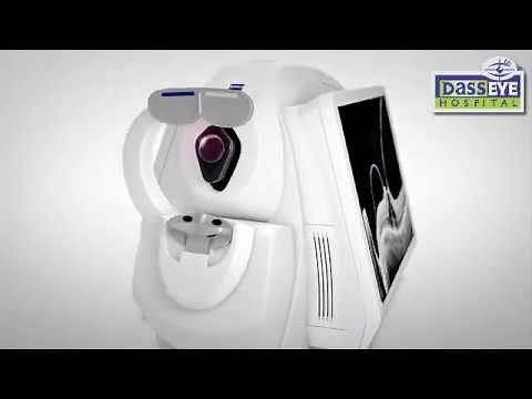 CIRRUS HD-OCT 5000 Advancing SMART OCT at Dass Eye Hospital