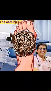 How can one explain and treat leg surgery for boys using 2D animation? Part 1 | the gaming 500