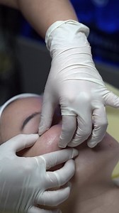 Our HydraFacial massage not only boosts your glow — it relaxes facial muscles, improves circulation, and helps your skin absorb hydration more deeply. Book your HydraFacial experience today. Available in Las Piñas, Makati & Quezon City. #hydrafacial #facial #skincare #selfcare #lymphaticdrainagemassage | Miss Derm | Facebook