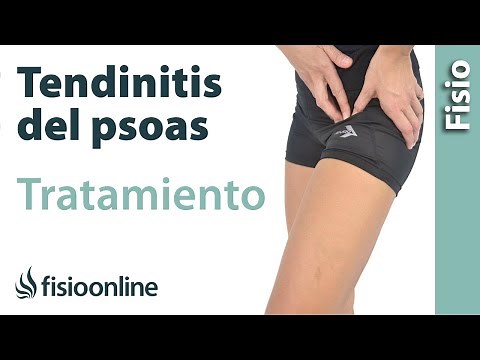 Psoas tendonitis - Treatment with exercises, self-massage, and stretching