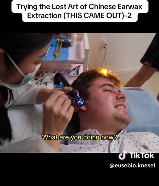 Trying the Lost Art of Chinese Earwax Extraction (THIS CAME OUT)-2 #earwax