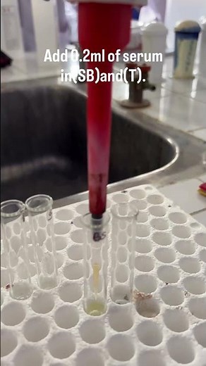 Estimation of TIBC in Serum – Manual Method Explained Clearly #vamsi_mlt