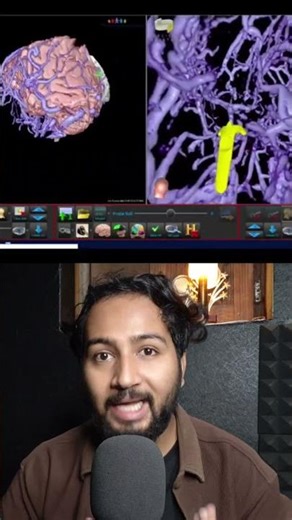 Brain Surgery With VR 😱