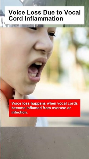 Voice Loss Due to Vocal Cord Inflammation - OTOMOTIPS