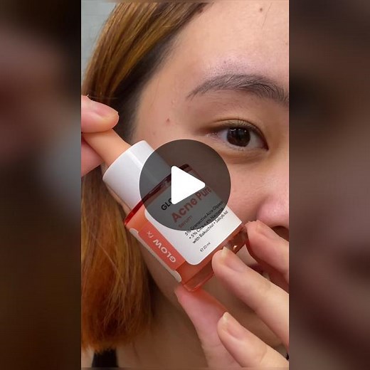 Lagi punya masalah jerawat? Jangan khawatir! Sekarang sudah ada Acne Pure, serum penghempas jerawat! 🥳🫶🏻
