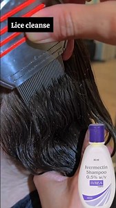 Lice & nits treatment | Best Lice Comb for Easy Removal! 🪮✨ #liceremoval #licetreatment#piojos