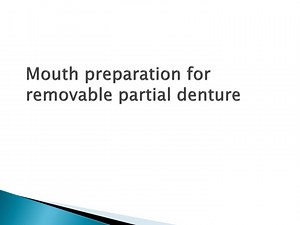 PPT - Mouth preparation for removable partial denture PowerPoint Presentation - ID:8976083
