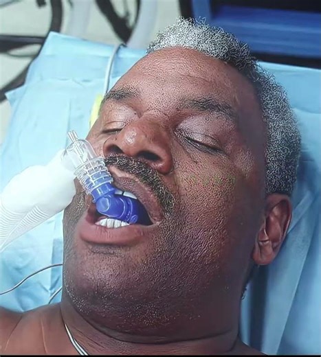 Mr Bean effortlessly removed the shell casing, leaving all the doctors feeling ashamed #edit