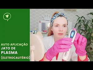Fazendo Jato de Plasma (eletrocautério) em casa! Auto aplicação passo a passo de jato de plasma.