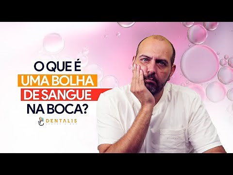 O que é uma bolha de sangue na boca?