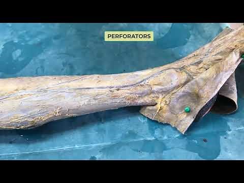 Great (Long) saphenous vein: Gross and Clinical Anatomy