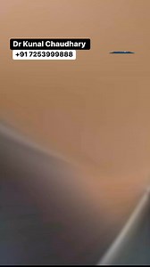 1M views · 10K reactions | #bodybuilding #fitness #gym #workout #fitnessmotivation #motivation #fit #muscle #training #gymmotivation #fitnessmodel#Shorts#Trending#Viral#ExplorePage#ForYouPage#InstaRee Is#FacebookReels#VideoOfTheDay#TrendingNow#Popular#SocialMediaMarketing#Entertainment#Fun#Challenge | Healthy Wealthy | Facebook