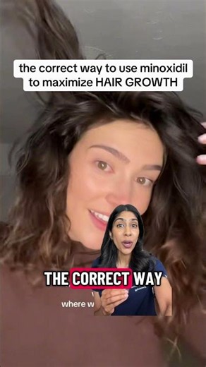 correct way to use minoxidil to maximize results ‪@Kaaiiyesdigitaldiary‬ rbrigitte7 sofiahairhealth