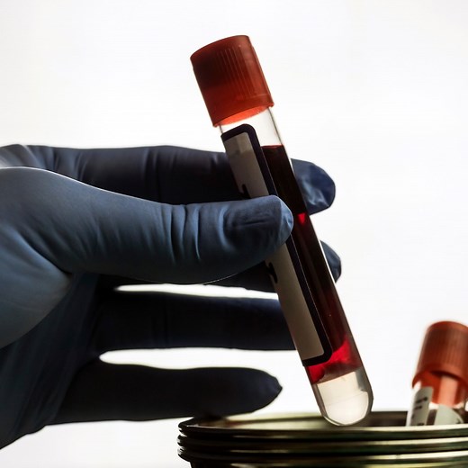 159K views · 1.9K shares | Researchers develop a blood test for multiple sclerosis. | Hashem Al-Ghaili | Facebook