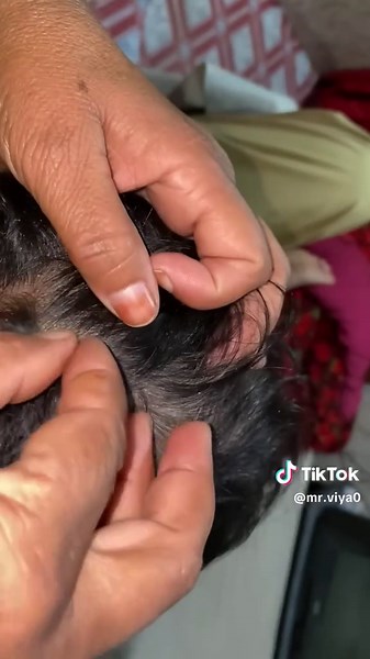 Incredible Hair Discovery: What Did I Find?