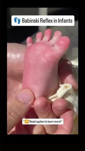 Your feet can reveal brain health,Babinski Reflex explained #medicalfacts #educationalvideo #doctors