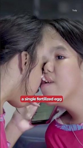 Conjoined Twins Who Share a Brain? The Schappell Story |