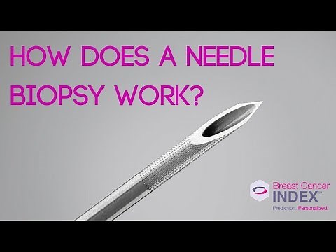 How Does a Needle Biopsy Work?