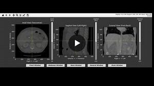 Building a simple Python medical imaging viewer | Chitra Singh posted on the topic | LinkedIn