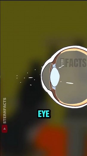 Why Eye Tests Always Show a House or Hot Air Balloon 👀🏠🎈