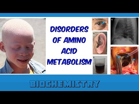 disorders of amino acid metabolism
