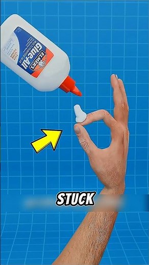 Super Glue on Your Fingers? Do THIS 😳