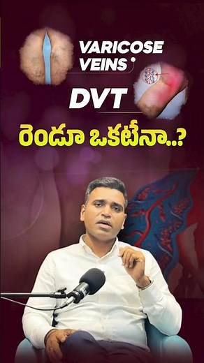 Varicose Veins vs DVT – What’s the Difference? | Dr. Sridhar Devu