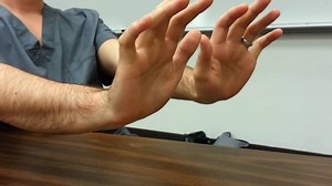 8.6K views · 67 reactions | Asterixis (also called the flapping...