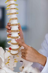 Lumbar Disc Replacement Surgery in 2023