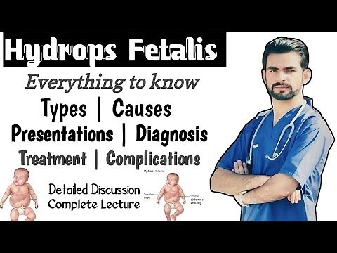Hydrops Fetalis || causes, types, management, complications