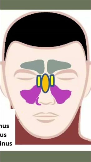 Periorbital Cellulitis: Causes, Symptoms, and Treatments #shorts