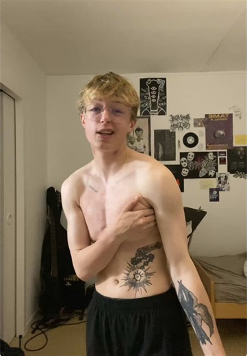 16 Days After Top Surgery: A Personal Reflection