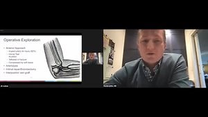 Pediatric Elbow Fractures - How to Keep Them Simple