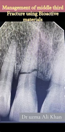 Expert Dental Care: Dr. Uzma Ali Khan's Services