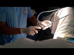 Cystoscope 22 October 2017