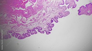 Section of human vagina magnified under microscope 40x on bright field background. Study of the female reproductive system in the field of gynecology. Examining tissue samples to analyze structure