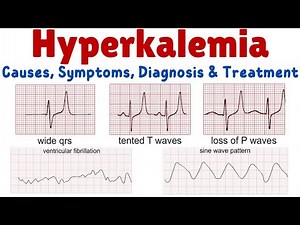 Hyperkalemia (High Potassium) – Causes, Symptoms, Diagnosis and Treatment