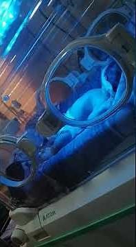 case 540 benign neonatal sleep myoclonic, seizures, triggered by benzodiazepine dr zuhair