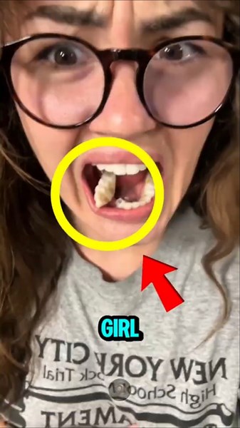 Her Tooth Cracked In Half While Brushing... Then THIS Happened 😱🦷